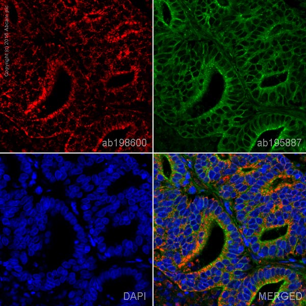 Immunohistochemistry (Formalin/PFA-fixed paraffin-embedded sections) - Alexa Fluor® 647 Anti-MTCO1 antibody [1D6E1A8] (AB198600), expandable thumbnail