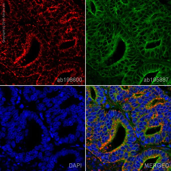 Immunohistochemistry (Formalin/PFA-fixed paraffin-embedded sections) - Alexa Fluor® 647 Anti-MTCO1 antibody [1D6E1A8] (AB198600)