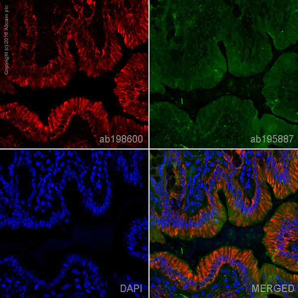 Immunohistochemistry (Frozen sections) - Alexa Fluor® 647 Anti-MTCO1 antibody [1D6E1A8] (AB198600)