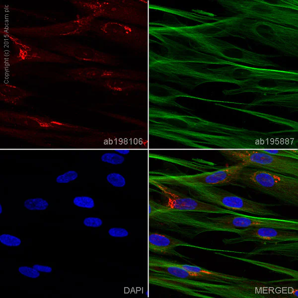 Immunocytochemistry/ Immunofluorescence - Alexa Fluor® 647 Anti-mtTFA antibody [18G102B2E11] - Mitochondrial Marker (AB198106)