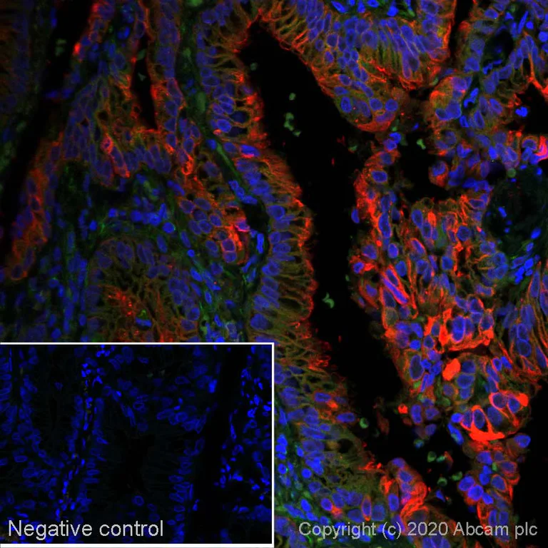 Immunohistochemistry (Formalin/PFA-fixed paraffin-embedded sections) - Alexa Fluor® 647 Anti-MUC4 antibody [SP241] (AB267547)