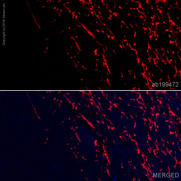 Immunohistochemistry (Formalin/PFA-fixed paraffin-embedded sections) - Alexa Fluor® 647 Anti-Myelin oligodendrocyte glycoprotein antibody [EP4281] - Oligodendrocyte Marker (AB199472)