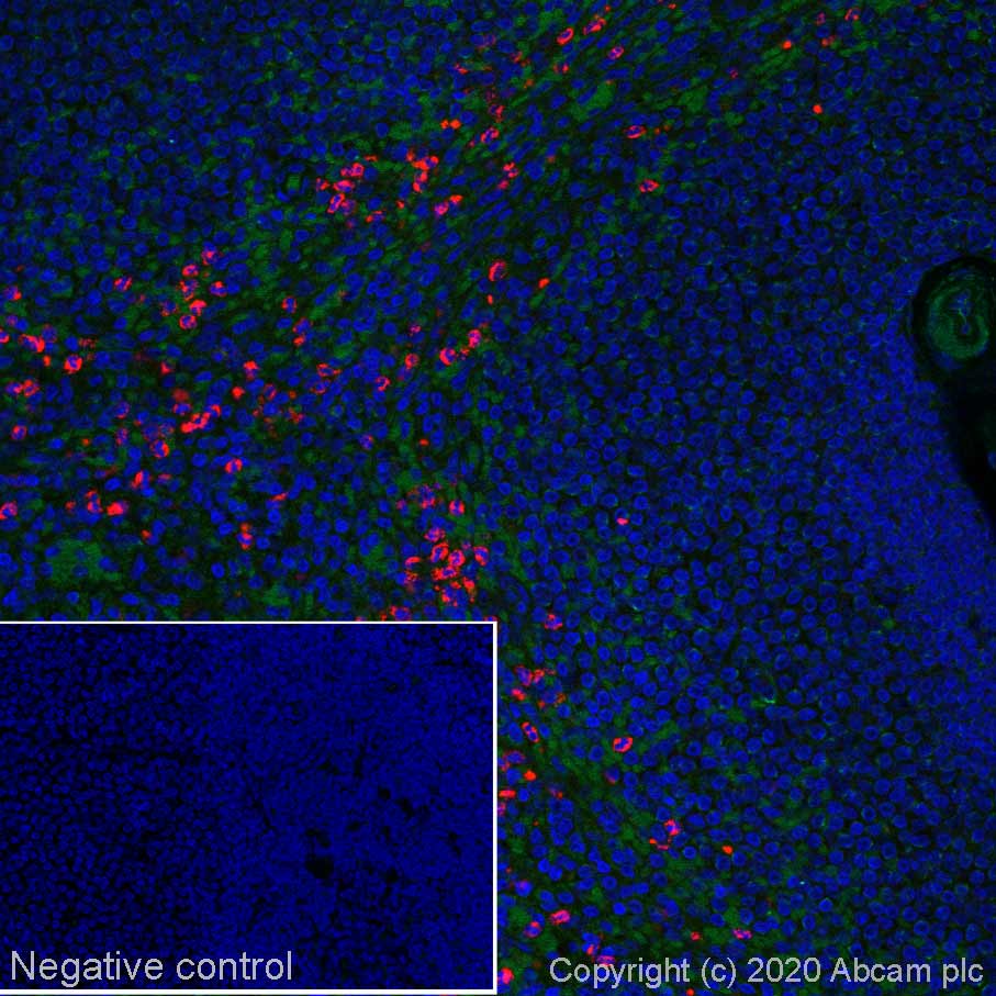 Immunohistochemistry (Formalin/PFA-fixed paraffin-embedded sections) - Alexa Fluor® 647 Anti-Myeloperoxidase antibody [EPR17996] (AB252131), expandable thumbnail