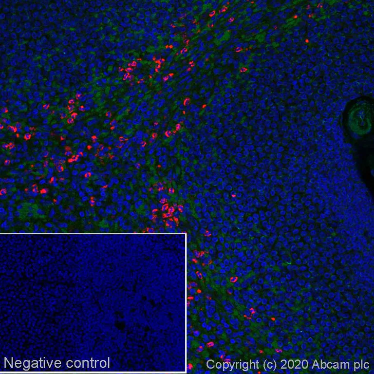 Immunohistochemistry (Formalin/PFA-fixed paraffin-embedded sections) - Alexa Fluor® 647 Anti-Myeloperoxidase antibody [EPR17996] (AB252131)