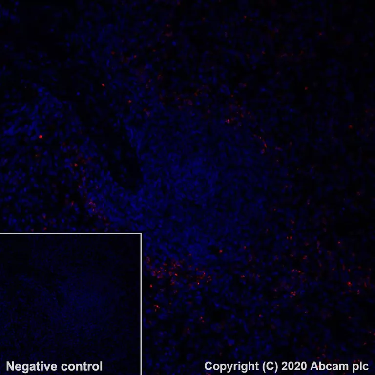 Immunohistochemistry (Formalin/PFA-fixed paraffin-embedded sections) - Alexa Fluor® 647 Anti-Myeloperoxidase antibody [SP72] (AB279686)