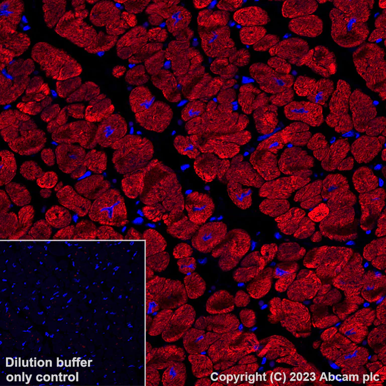 Immunohistochemistry (Formalin/PFA-fixed paraffin-embedded sections) - Alexa Fluor® 647 Anti-Myosin heavy chain antibody [A4.1025] (AB315963)