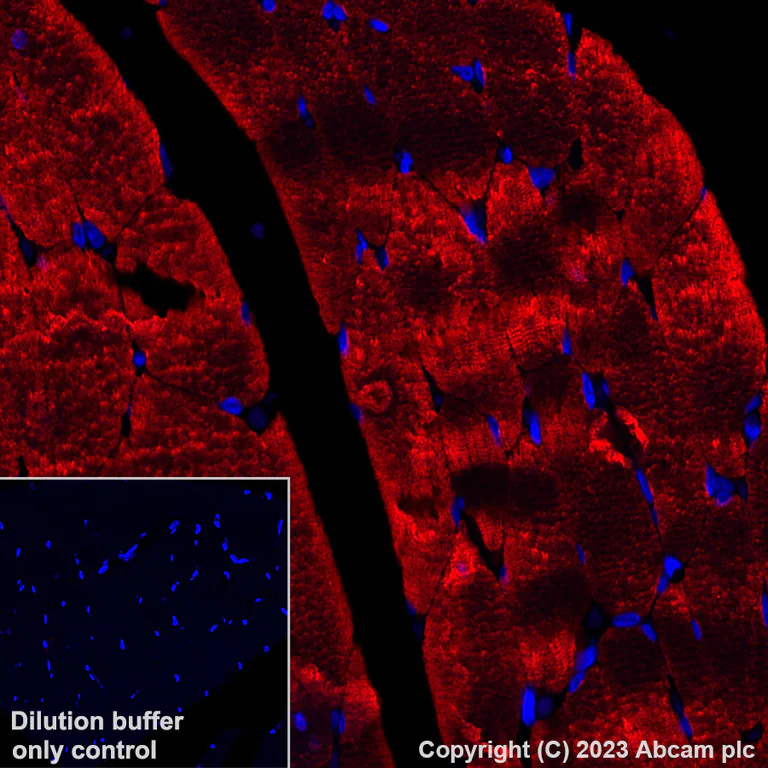 Immunohistochemistry (Formalin/PFA-fixed paraffin-embedded sections) - Alexa Fluor® 647 Anti-Myosin heavy chain antibody [A4.1025] (AB315963)