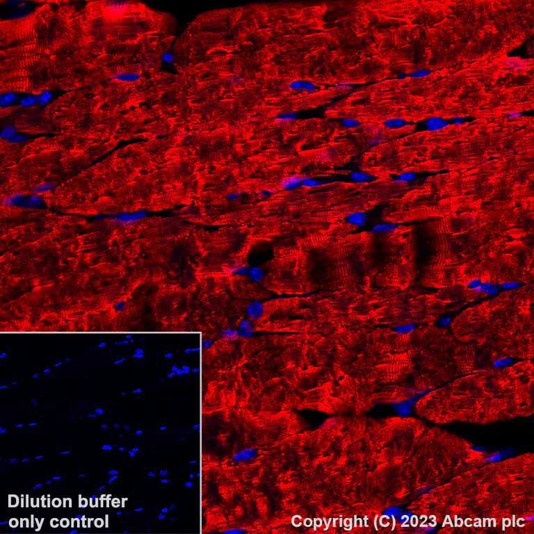 Immunohistochemistry (Formalin/PFA-fixed paraffin-embedded sections) - Alexa Fluor® 647 Anti-Myosin heavy chain antibody [A4.1025] (AB315963)