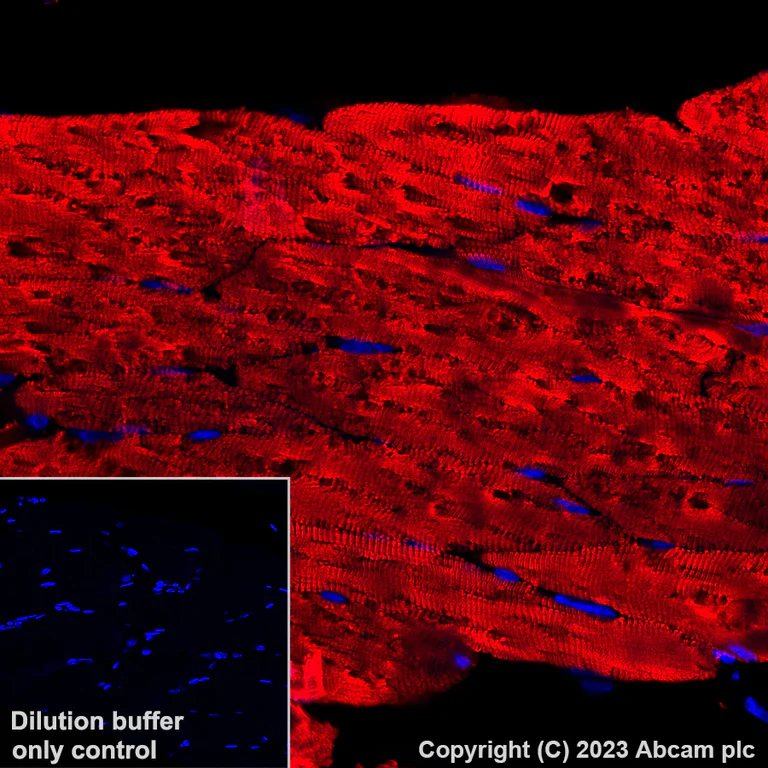 Immunohistochemistry (Formalin/PFA-fixed paraffin-embedded sections) - Alexa Fluor® 647 Anti-Myosin heavy chain antibody [A4.1025] (AB315963)