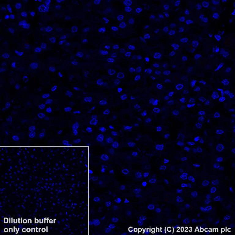Immunohistochemistry (Formalin/PFA-fixed paraffin-embedded sections) - Alexa Fluor® 647 Anti-Myosin heavy chain antibody [A4.1025] (AB315963)
