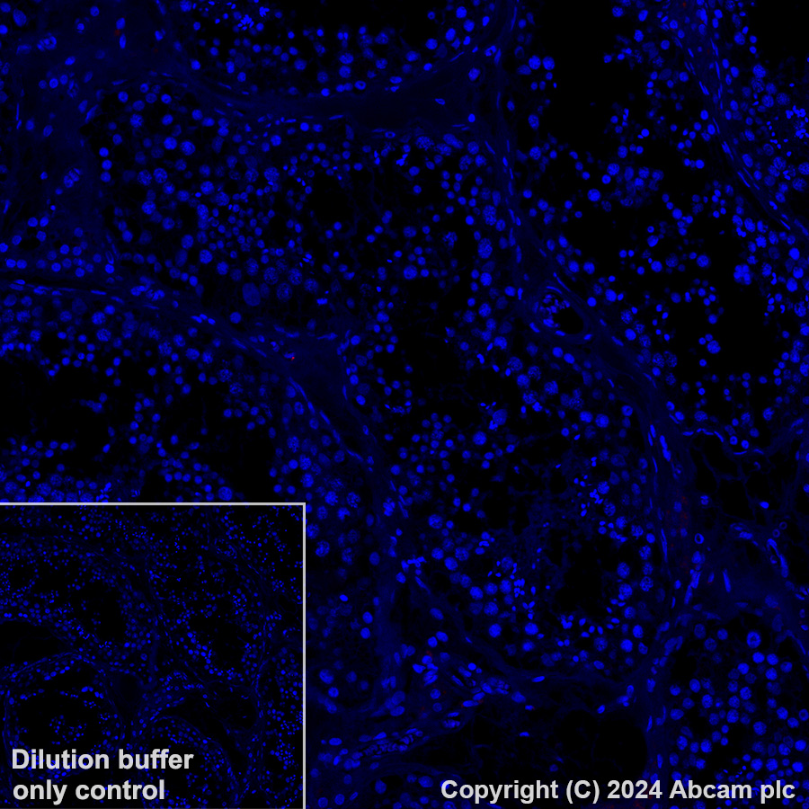 Immunohistochemistry (Formalin/PFA-fixed paraffin-embedded sections) - Alexa Fluor® 647 Anti-NALP12/NLRP12 antibody [EPR26985-39] (AB317292), expandable thumbnail