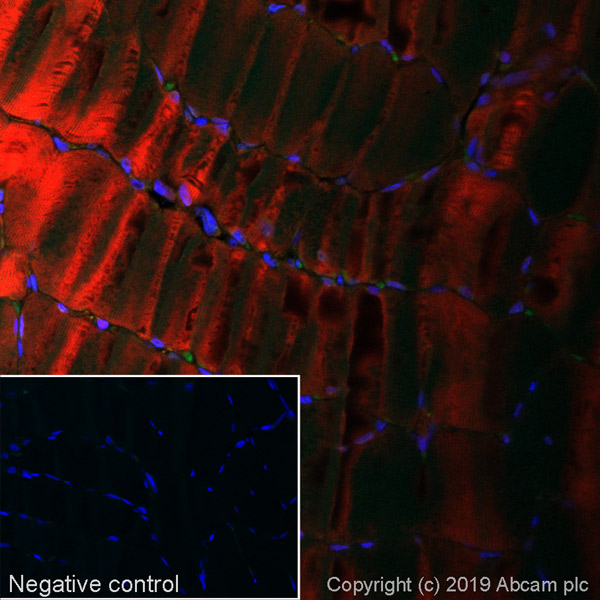 Immunohistochemistry (Formalin/PFA-fixed paraffin-embedded sections) - Alexa Fluor® 647 Anti-NDRG2 antibody [EPR11910] (AB252067)