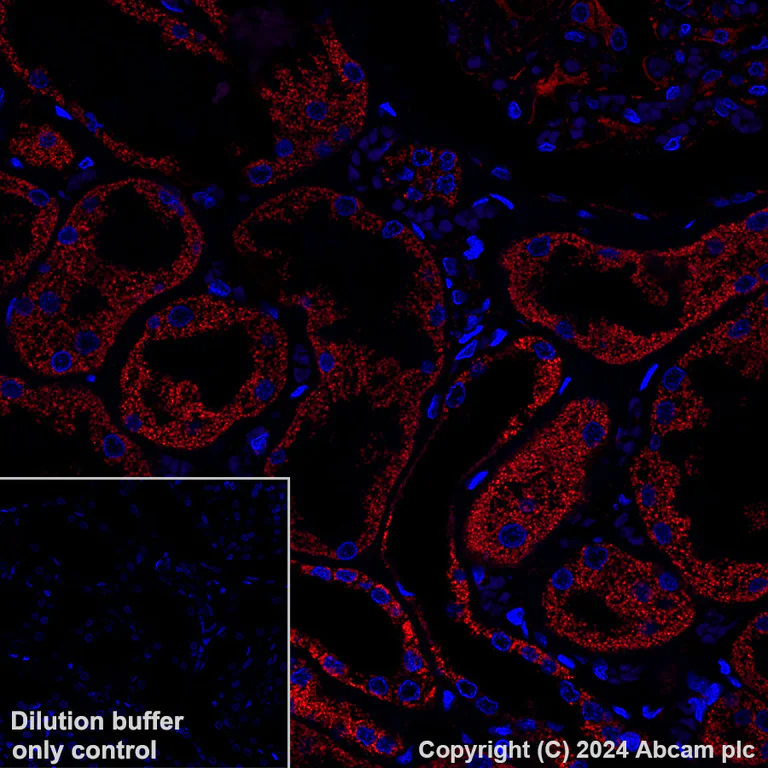 Immunohistochemistry (Formalin/PFA-fixed paraffin-embedded sections) - Alexa Fluor® 647 Anti-NDUFB8 antibody [EPR15961] (AB317711)
