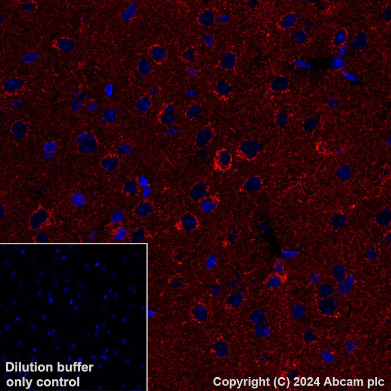 Immunohistochemistry (Formalin/PFA-fixed paraffin-embedded sections) - Alexa Fluor® 647 Anti-NDUFB8 antibody [EPR15961] (AB317711)
