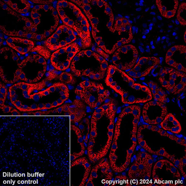 Immunohistochemistry (Formalin/PFA-fixed paraffin-embedded sections) - Alexa Fluor® 647 Anti-NDUFB8 antibody [EPR15961] (AB317711)