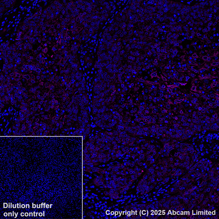 Immunohistochemistry (Formalin/PFA-fixed paraffin-embedded sections) - Alexa Fluor® 647 Anti-Nectin 3 antibody [EPR26326-22] (AB323441), expandable thumbnail