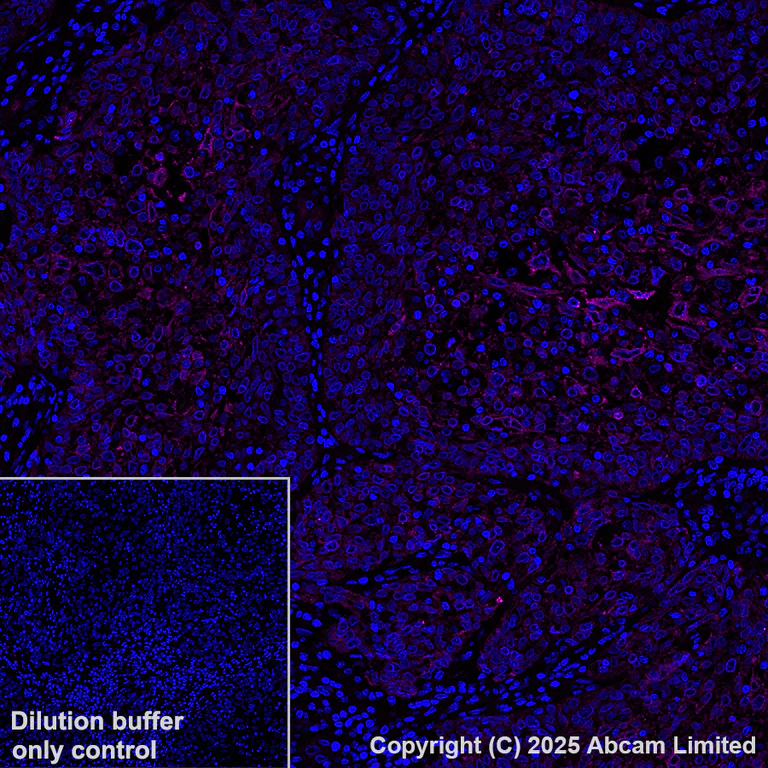 Immunohistochemistry (Formalin/PFA-fixed paraffin-embedded sections) - Alexa Fluor® 647 Anti-Nectin 3 antibody [EPR26326-22] (AB323441)