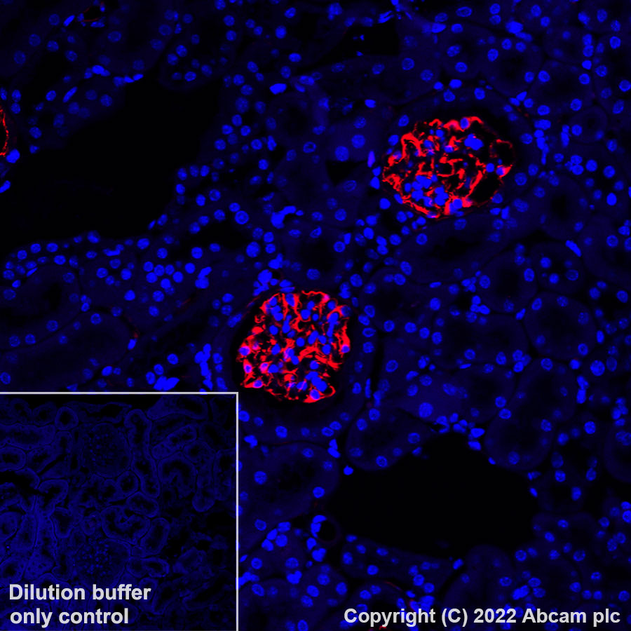 Immunohistochemistry (Formalin/PFA-fixed paraffin-embedded sections) - Alexa Fluor® 647 Anti-Nestin antibody [EPR22023] - Neural Stem Cell Marker (AB306599), expandable thumbnail