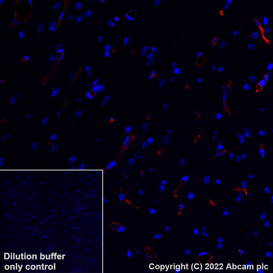Immunohistochemistry (Formalin/PFA-fixed paraffin-embedded sections) - Alexa Fluor® 647 Anti-Nestin antibody [EPR22023] - Neural Stem Cell Marker (AB306599), expandable thumbnail