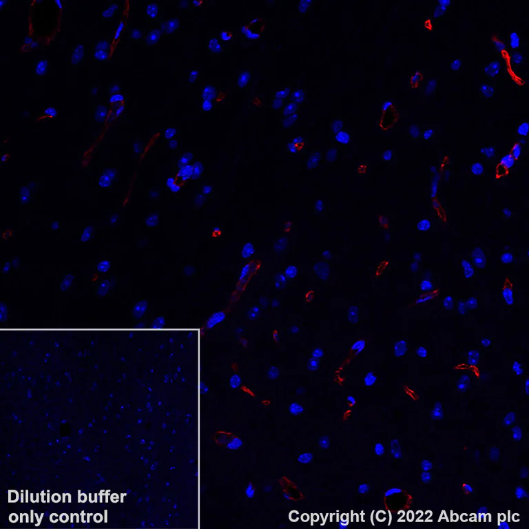 Immunohistochemistry (Formalin/PFA-fixed paraffin-embedded sections) - Alexa Fluor® 647 Anti-Nestin antibody [EPR22023] - Neural Stem Cell Marker (AB306599)