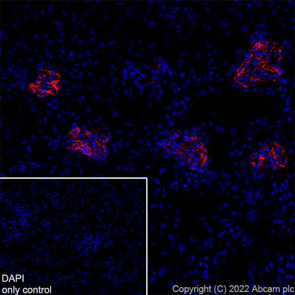 Immunohistochemistry (Frozen sections) - Alexa Fluor® 647 Anti-Nestin antibody [EPR22023] - Neural Stem Cell Marker (AB306599), expandable thumbnail