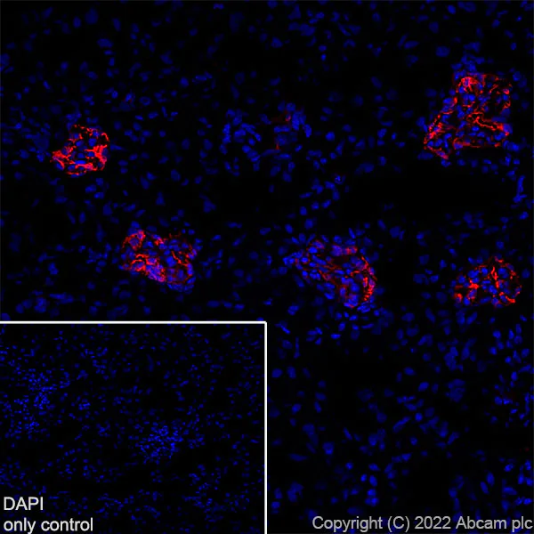 Immunohistochemistry (Frozen sections) - Alexa Fluor® 647 Anti-Nestin antibody [EPR22023] - Neural Stem Cell Marker (AB306599)