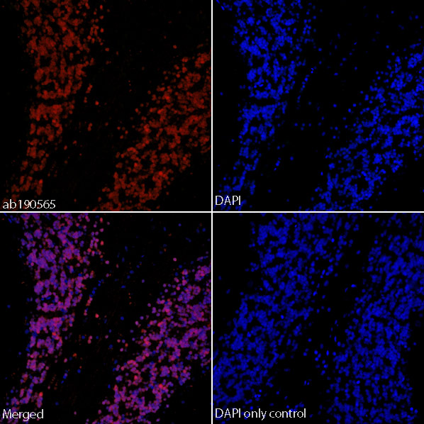 Immunohistochemistry (Formalin/PFA-fixed paraffin-embedded sections) - Alexa Fluor® 647 Anti-NeuN antibody [EPR12763] - Neuronal Marker (AB190565), expandable thumbnail