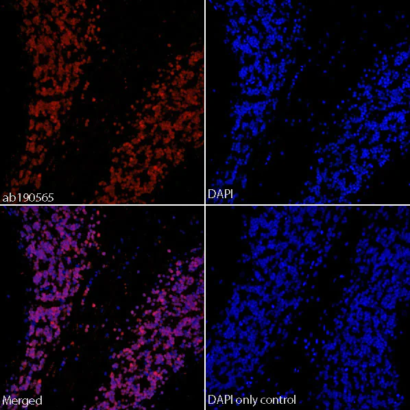 Immunohistochemistry (Formalin/PFA-fixed paraffin-embedded sections) - Alexa Fluor® 647 Anti-NeuN antibody [EPR12763] - Neuronal Marker (AB190565)