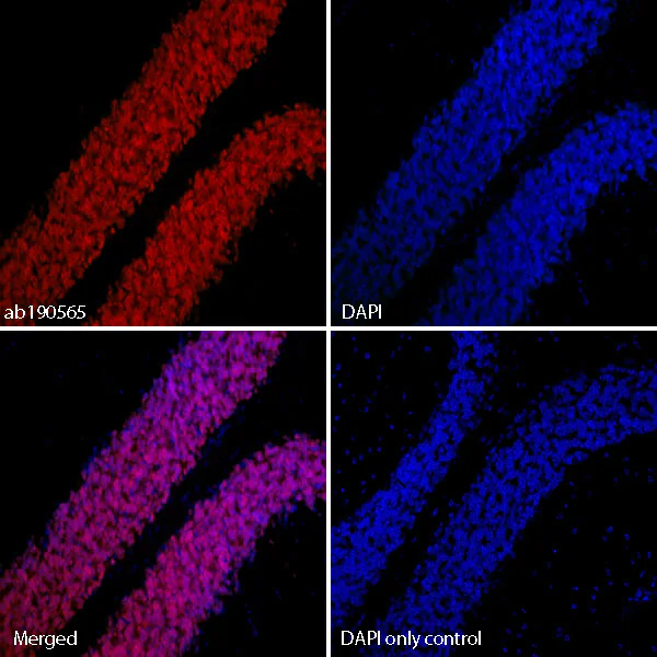 Immunohistochemistry (Formalin/PFA-fixed paraffin-embedded sections) - Alexa Fluor® 647 Anti-NeuN antibody [EPR12763] - Neuronal Marker (AB190565)