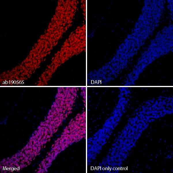 Immunohistochemistry (Formalin/PFA-fixed paraffin-embedded sections) - Alexa Fluor® 647 Anti-NeuN antibody [EPR12763] - Neuronal Marker (ab190565), expandable thumbnail