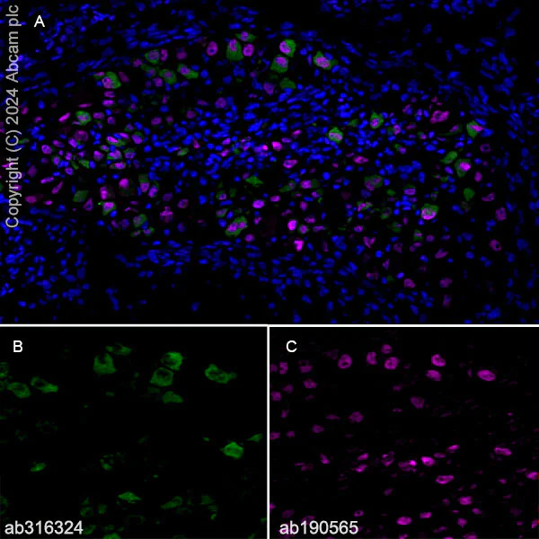 Immunohistochemistry (Frozen sections) - Alexa Fluor® 647 Anti-NeuN antibody [EPR12763] - Neuronal Marker (AB190565)