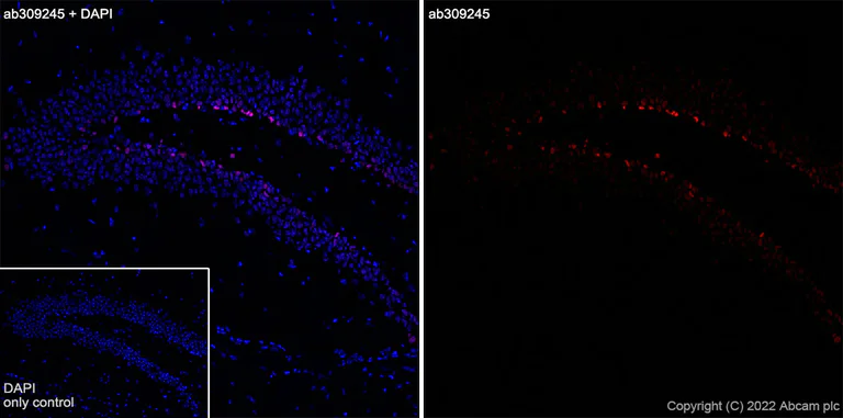 Immunohistochemistry (Frozen sections) - Alexa Fluor® 647 Anti-NeuroD1 antibody [EPR17084] (AB309245)