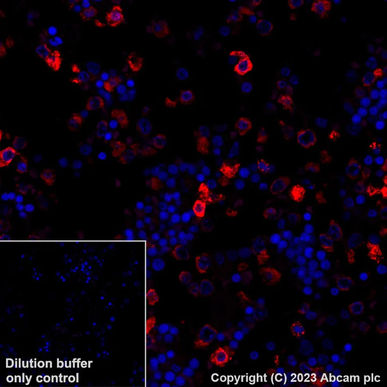 Immunohistochemistry (Formalin/PFA-fixed paraffin-embedded sections) - Alexa Fluor® 647 Anti-Neutrophil Elastase antibody [EPR7479] (AB310127)