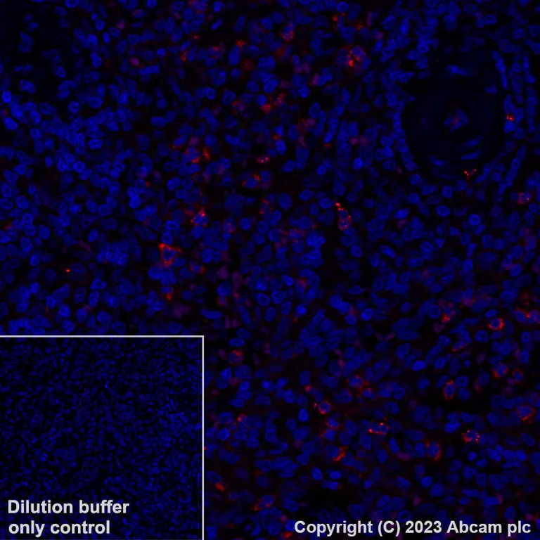 Immunohistochemistry (Formalin/PFA-fixed paraffin-embedded sections) - Alexa Fluor® 647 Anti-Neutrophil Elastase antibody [EPR7479] (AB310127)