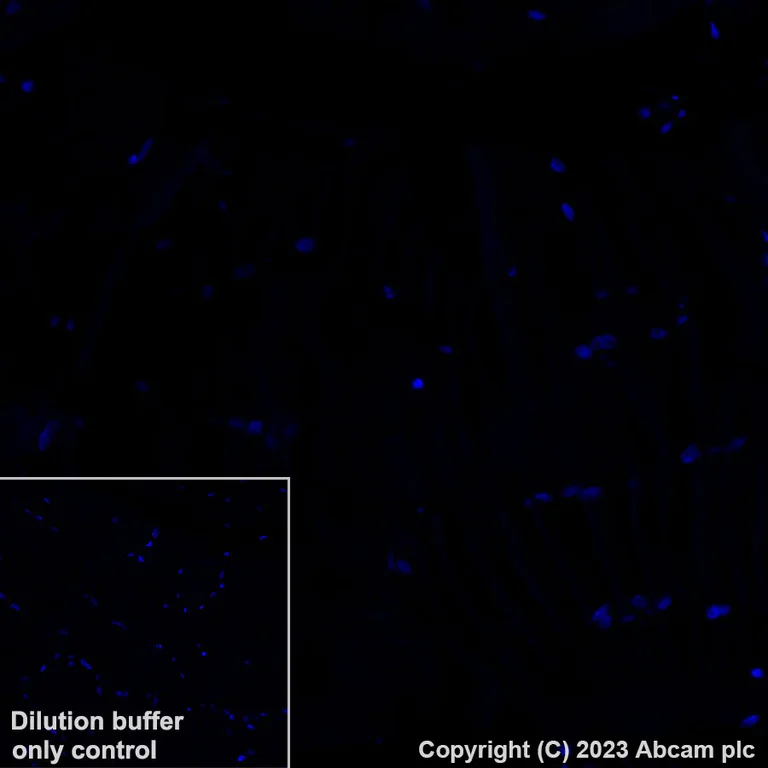 Immunohistochemistry (Formalin/PFA-fixed paraffin-embedded sections) - Alexa Fluor® 647 Anti-Neutrophil Elastase antibody [EPR7479] (AB310127)