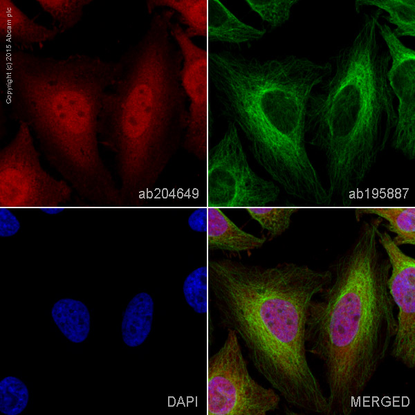 Immunocytochemistry/ Immunofluorescence - Alexa Fluor® 647 Anti-NF-kB p65 antibody [EP2161Y] (AB204649), expandable thumbnail