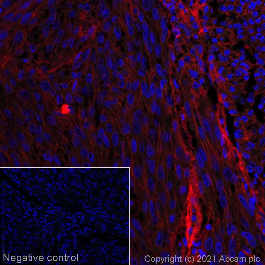 Immunohistochemistry (Formalin/PFA-fixed paraffin-embedded sections) - Alexa Fluor® 647 Anti-NG2 antibody [EPR20244] (AB270109), expandable thumbnail