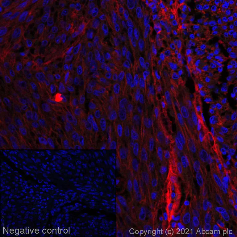 Immunohistochemistry (Formalin/PFA-fixed paraffin-embedded sections) - Alexa Fluor® 647 Anti-NG2 antibody [EPR20244] (AB270109)