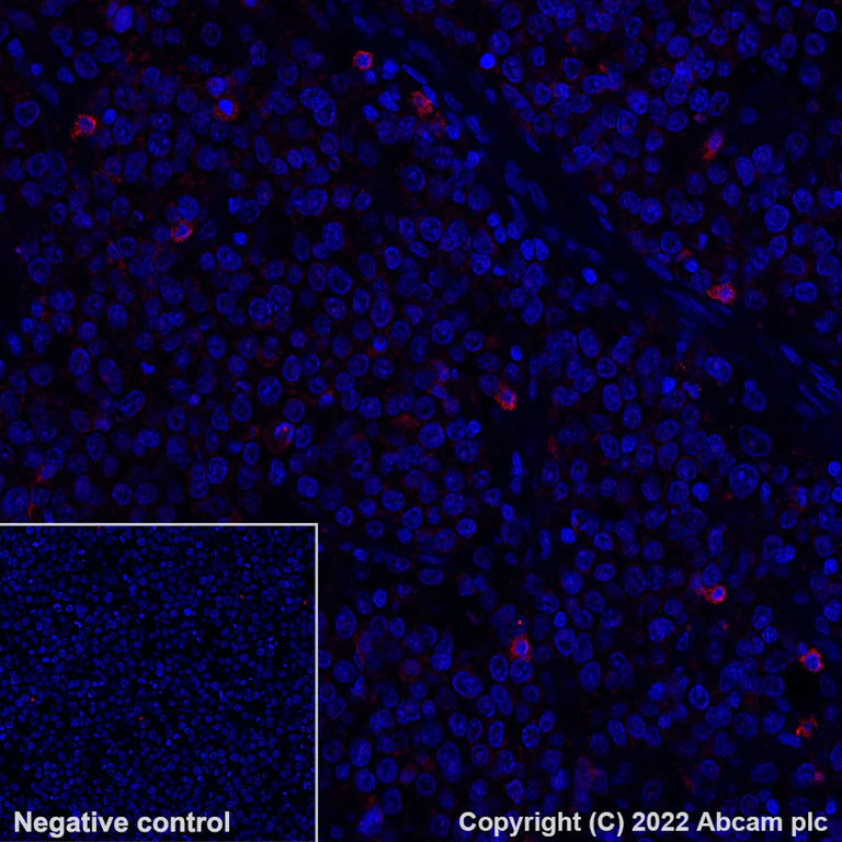Immunohistochemistry (Formalin/PFA-fixed paraffin-embedded sections) - Alexa Fluor® 647 Anti-NKG2A antibody [EPR23737-127] (AB300745)