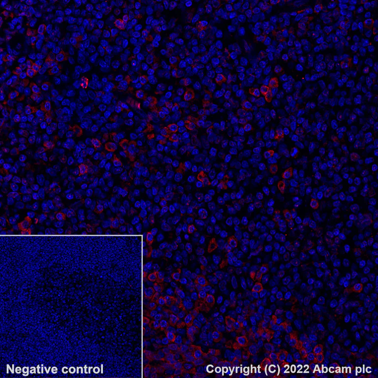 Immunohistochemistry (Formalin/PFA-fixed paraffin-embedded sections) - Alexa Fluor® 647 Anti-NKG2A antibody [EPR23737-127] (AB300745)