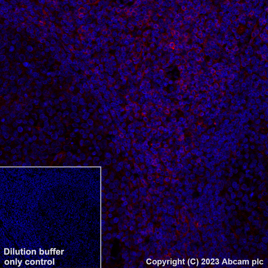 Immunohistochemistry (Formalin/PFA-fixed paraffin-embedded sections) - Alexa Fluor® 647 Anti-NKG2D antibody [EPR24072-342] (AB312904), expandable thumbnail