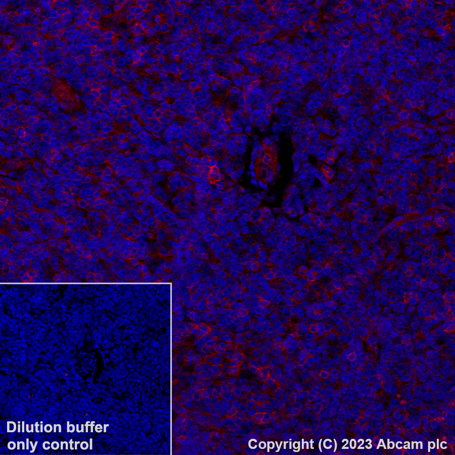 Immunohistochemistry (Formalin/PFA-fixed paraffin-embedded sections) - Alexa Fluor® 647 Anti-NKG2D antibody [EPR24072-342] (AB312904), expandable thumbnail