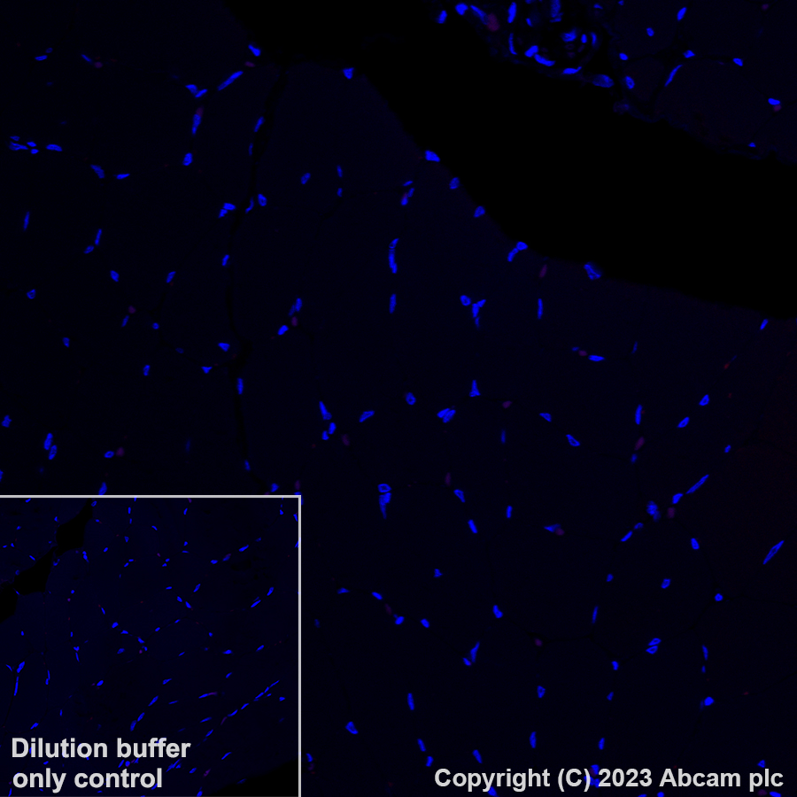 Immunohistochemistry (Formalin/PFA-fixed paraffin-embedded sections) - Alexa Fluor® 647 Anti-NKG2D antibody [EPR24072-342] (AB312904), expandable thumbnail