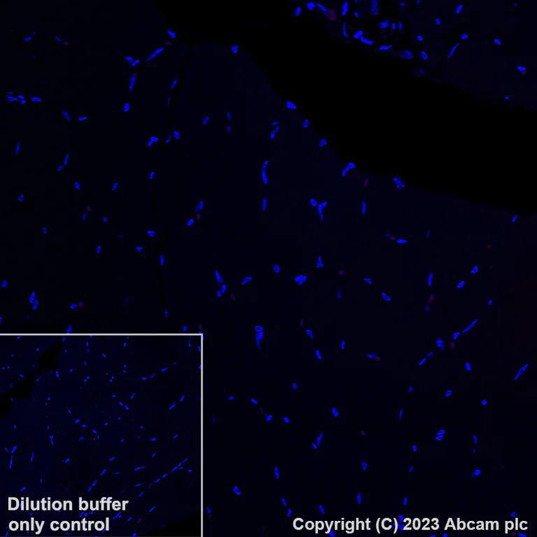 Immunohistochemistry (Formalin/PFA-fixed paraffin-embedded sections) - Alexa Fluor® 647 Anti-NKG2D antibody [EPR24072-342] (AB312904)