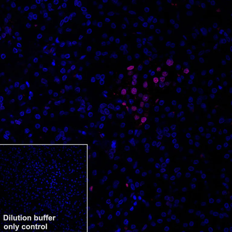 Immunohistochemistry (Formalin/PFA-fixed paraffin-embedded sections) - Alexa Fluor® 647 Anti-nkx6.1 antibody [EPR20405] (AB322233)