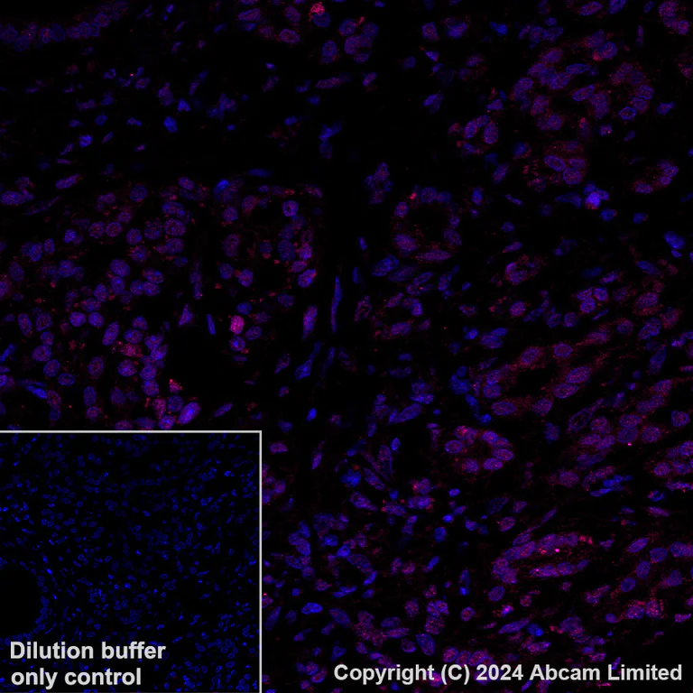 Immunohistochemistry (Formalin/PFA-fixed paraffin-embedded sections) - Alexa Fluor® 647 Anti-nkx6.1 antibody [EPR20405] (AB322233)