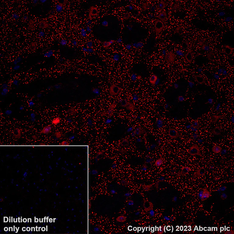 Immunohistochemistry (Formalin/PFA-fixed paraffin-embedded sections) - Alexa Fluor® 647 Anti-NMDAR1 antibody [EPR23397-66] - Neuronal Marker (AB308429)