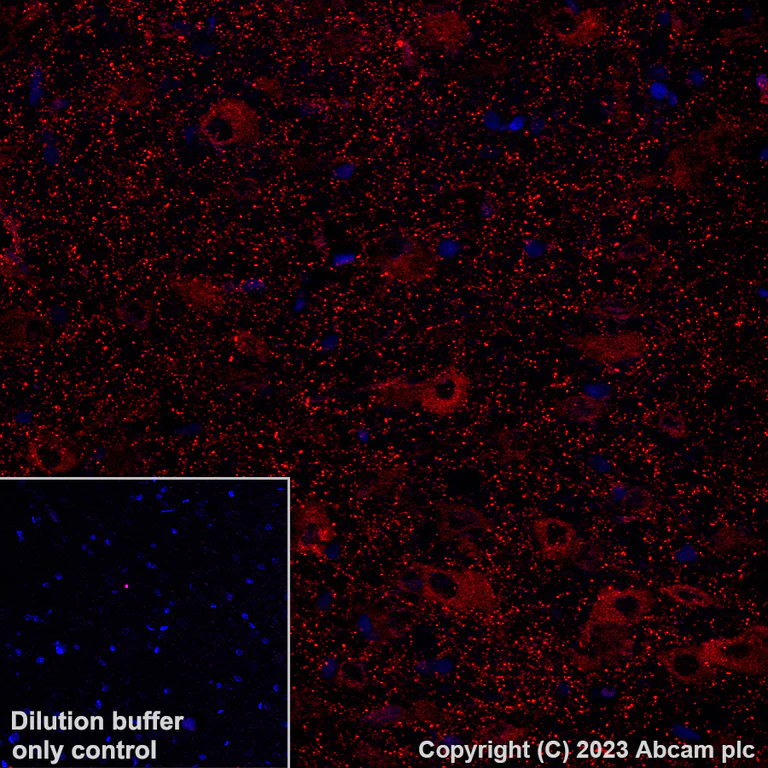 Immunohistochemistry (Formalin/PFA-fixed paraffin-embedded sections) - Alexa Fluor® 647 Anti-NMDAR1 antibody [EPR23397-66] - Neuronal Marker (AB308429)