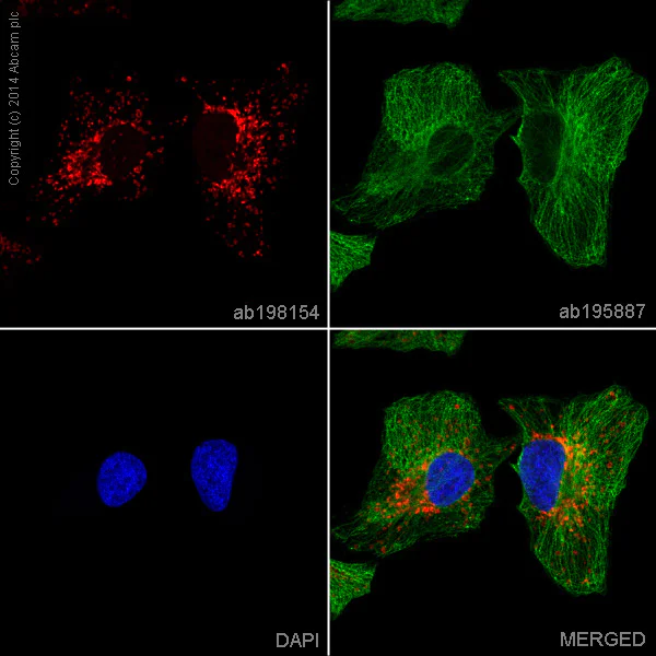 Immunocytochemistry/ Immunofluorescence - Alexa Fluor® 647 Anti-NNT antibody [8B4BB10] (AB198154)