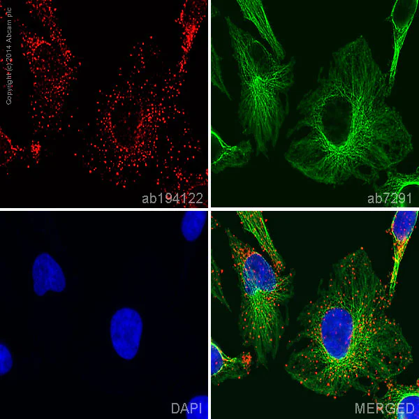 Immunocytochemistry/ Immunofluorescence - Alexa Fluor® 647 Anti-Notch1 antibody [EP1238Y] (AB194122)